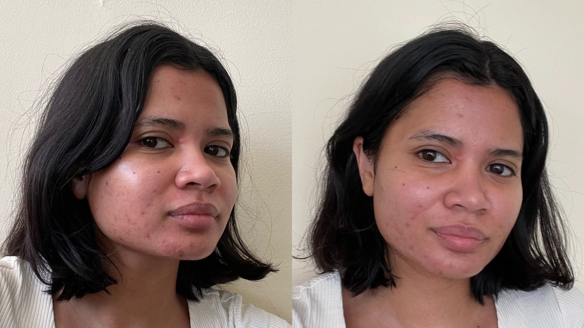 Elemis Pro Marine Collagen Cream Hanitra Before And After